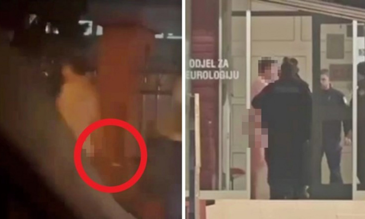 LJUDI SU SE SKAMENILI Potpuno go čovek šetao ulicom, najveći šok je usledio kada su mu videli ruke  (FOTO)